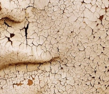 Retour de vacances : effet peau de serpent... Pourquoi ? Que faire ?